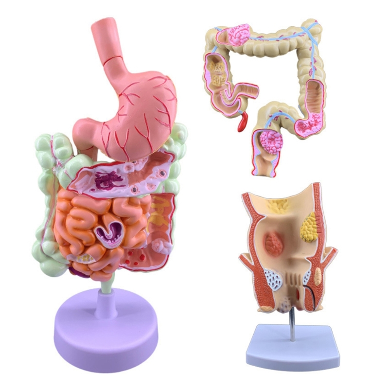 Medical Lab Observer - Modèle d'enseignement pathologie 3D Q6PA, affichage